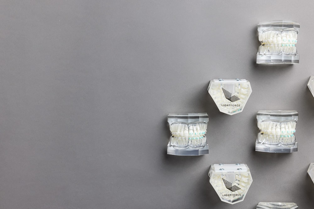 Lightforce Orthodontics &ndash; The Future of Braces Has Arrived