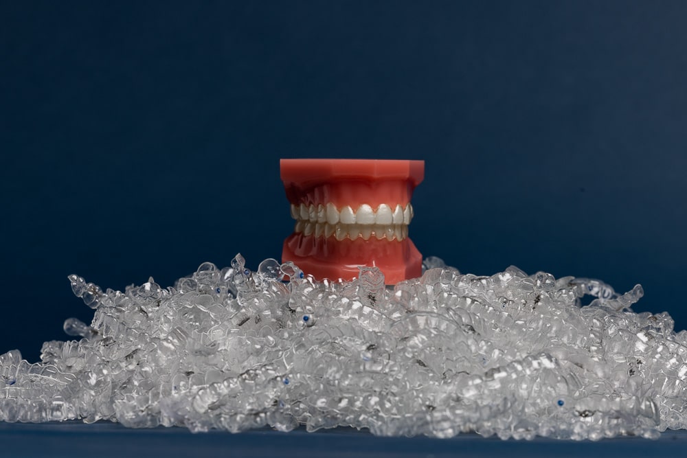 Should I Get Invisalign: The Top 3 Reasons to Consider an Invisalign Treatment