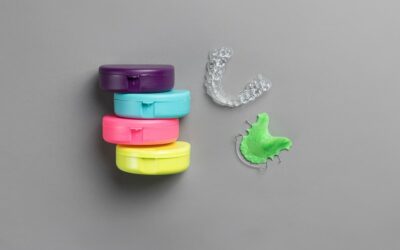 What Are The Best Retainers?